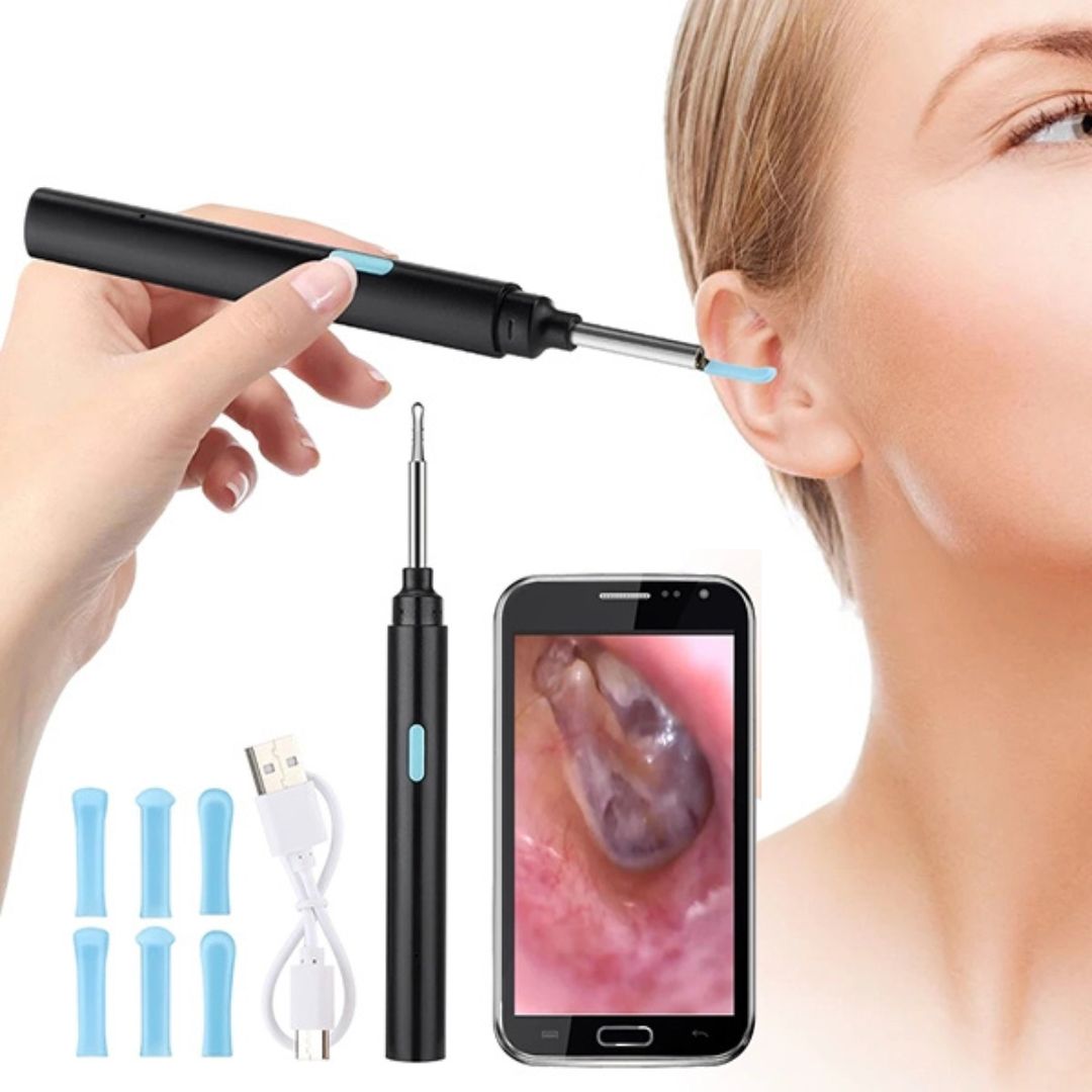 EarScope Pro - Smart Visual Earwax Removal Tool | LED Camera and Soft Tips - Safe and Precise Ear Cleaning Bowlift