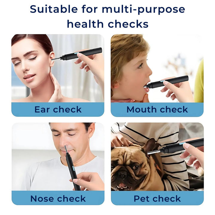 EarScope Pro - Smart Visual Earwax Removal Tool | LED Camera and Soft Tips - Safe and Precise Ear Cleaning Bowlift