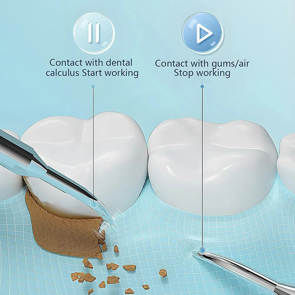 BowLift | Ultrasonic Teeth Cleaning Device | 38 kHz Ultrasound, LED Light & USB Fast Charging for Home Dental Care
