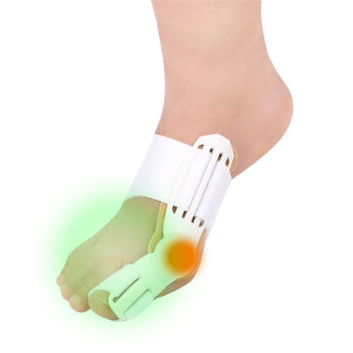BowLift | Splint Hallux Valgus for Bunion Correction Treatment
