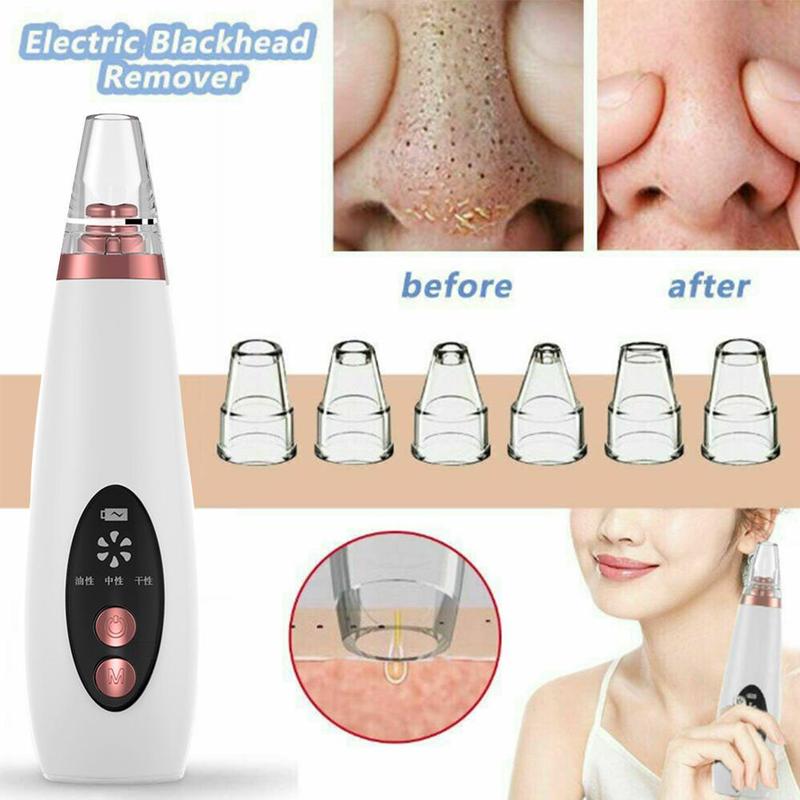 BowLift | Pure Skin Rechargeable Blackhead Remover Machine