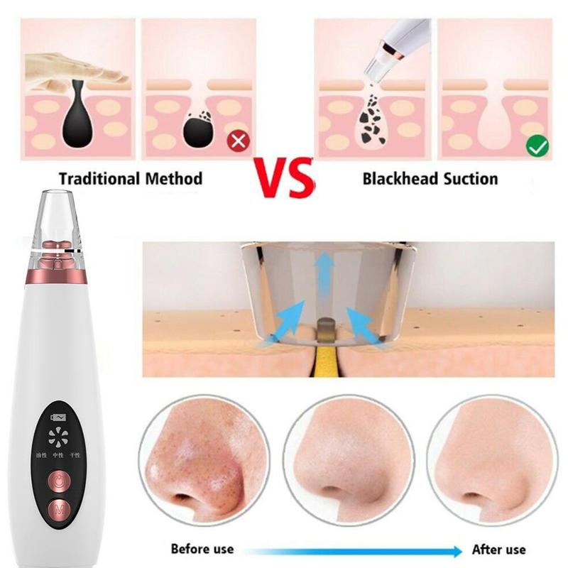 BowLift | Pure Skin Rechargeable Blackhead Remover Machine