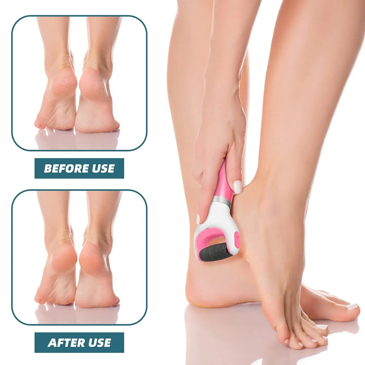 BowLift | USB Foot Callus Remover Pedicure Tool