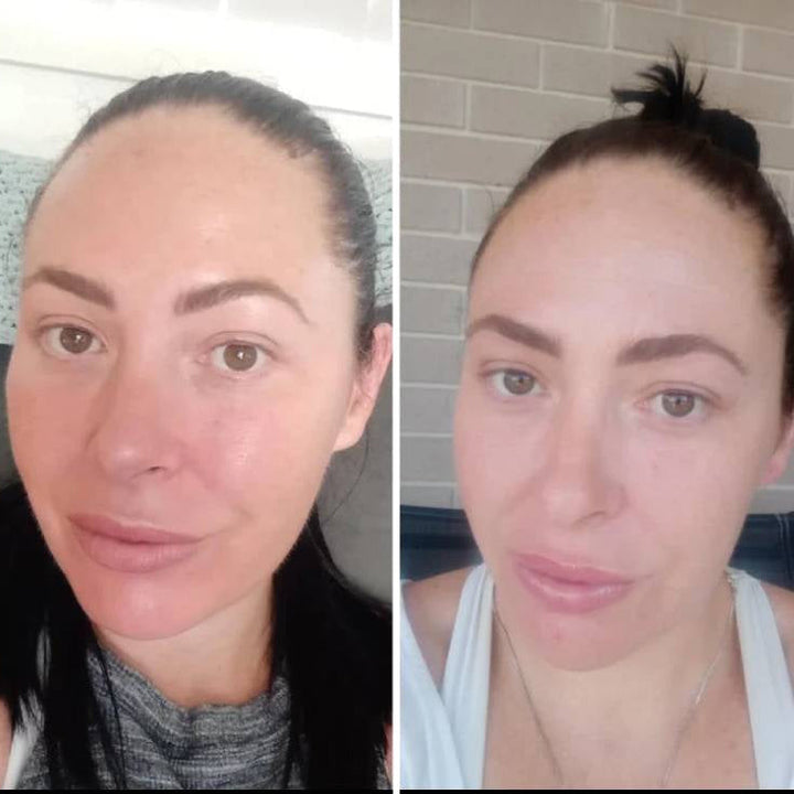 BowLift | LED Face Mask Light Therapy Skincare Device