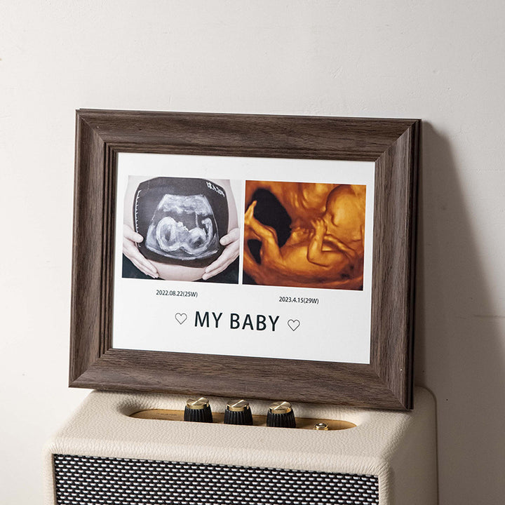 Personalized Ultrasound Photo Frame for Home Display