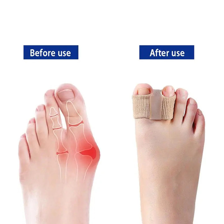 BowLift | Toe Separators for Bunions & Misalignment | Elastic Nylon + SEBS | Pain Relief & Posture Support