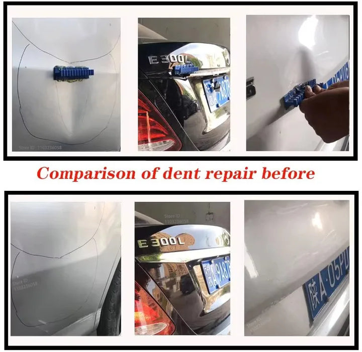 Dent Repair Tool Set Car Dents | Bowlift