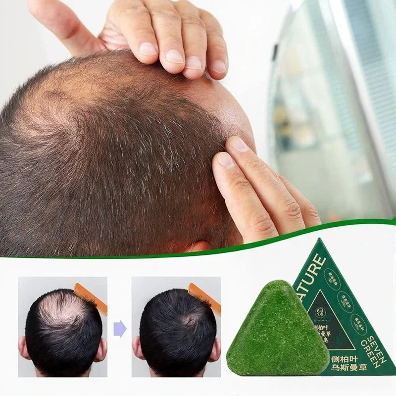 BowLift | Herbal Anti-Hair Loss Shampoo Bar
