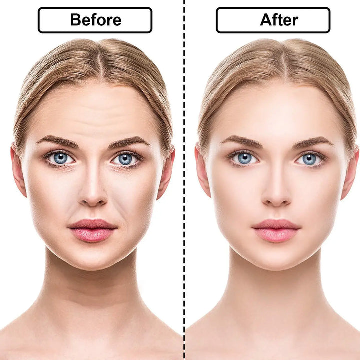 BowLift | Reusable Anti Wrinkle Silicone Sticker 16 Pcs