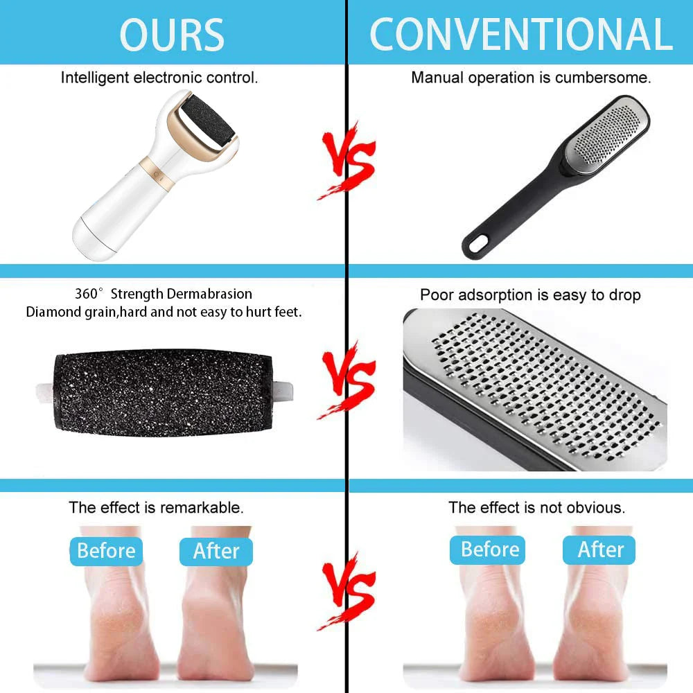 BowLift | USB Foot Callus Remover Pedicure Tool