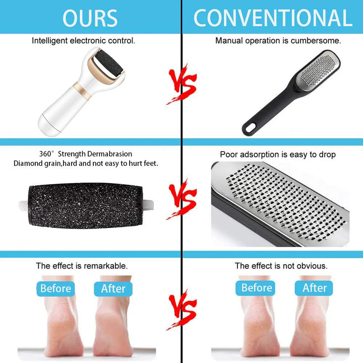 BowLift | USB Foot Callus Remover Pedicure Tool