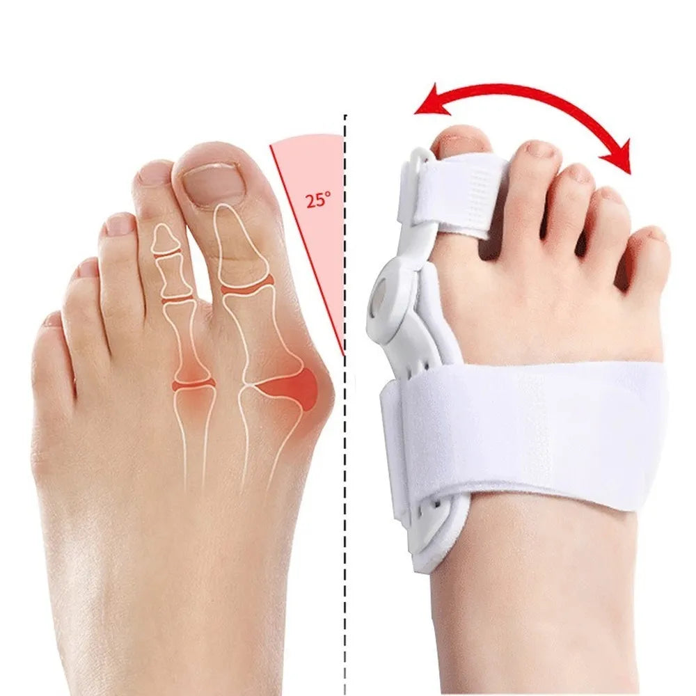 BowLift | Flexible Orthopaedic Bunion Corrector