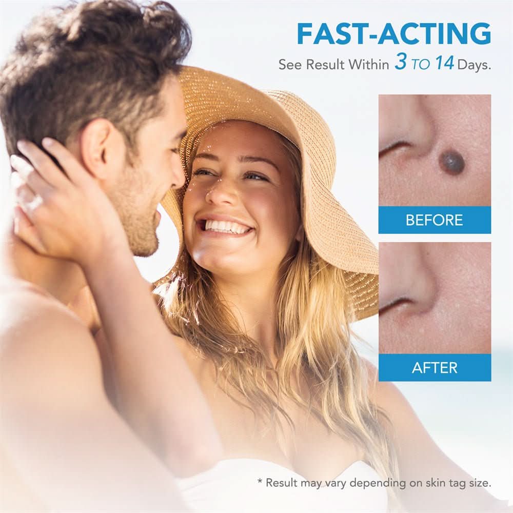 BowLift | Skin spot remover for warts & skin tags