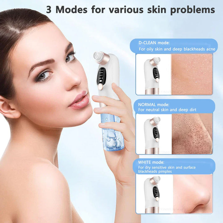 BowLift | Acne Black Head Deep Clean Removal