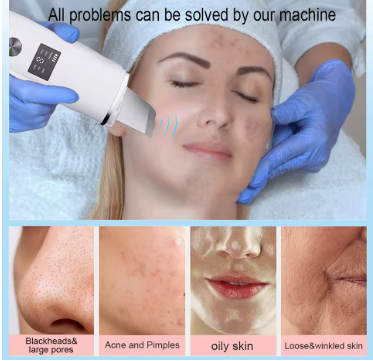 BowLift | SkinPure™ - Your skin is your calling card, let it shine like you deserve!