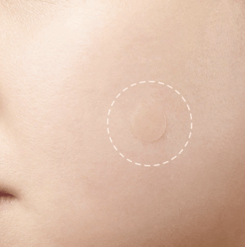 BowLift | Skin Tag and Acne Patch
