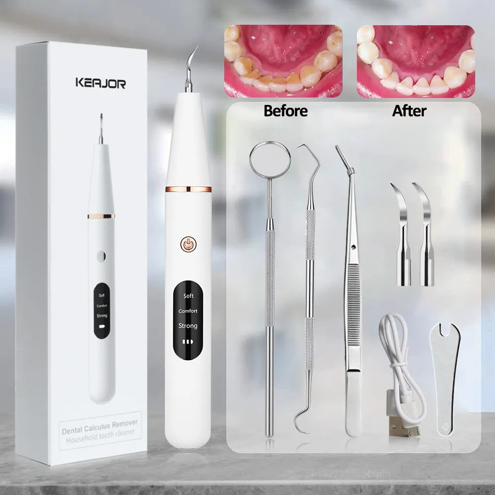 BowLift | Electric Dental Calculus Remover