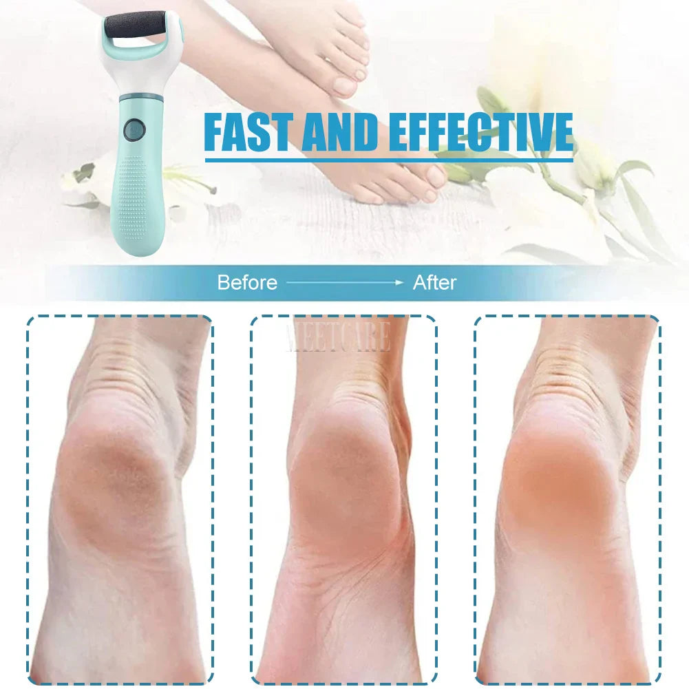 BowLift | Pedivance Electric Callus Remover with USB Charging | For gentle foot care & pedicure | Removes dry, cracked & calloused skin – 1200 mAh