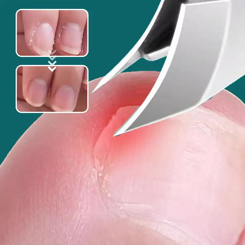 BowLift | Slant Edge Nail Clipper
