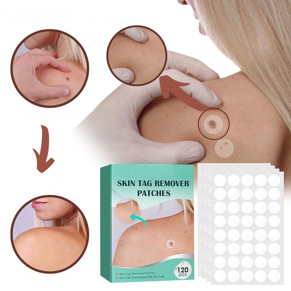 SkinClear - Patch for the removal of spots and warts Bowlift
