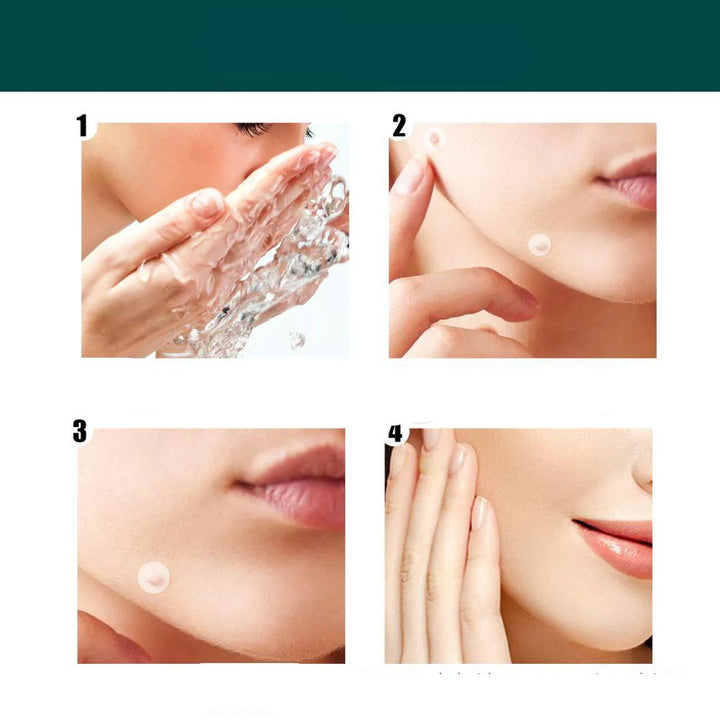 SkinClear - Patch for the removal of spots and warts Bowlift