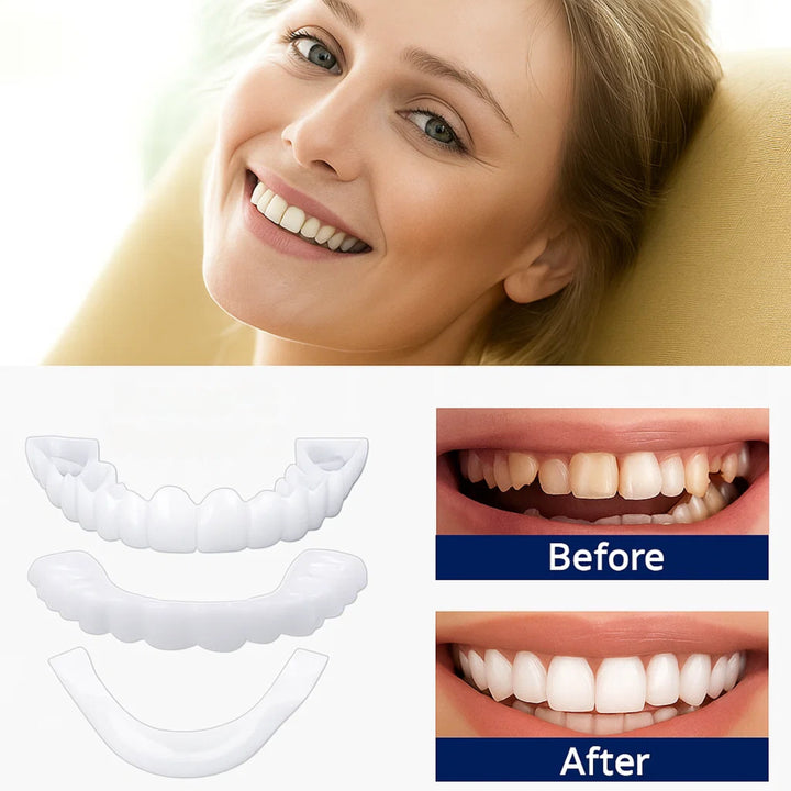 SmileEase | Clip-On Veneers – Instant Smile Enhancement – Ultra-Thin Design – Ideal for Adults Seeking Affordable Dental Solutions Bowlift