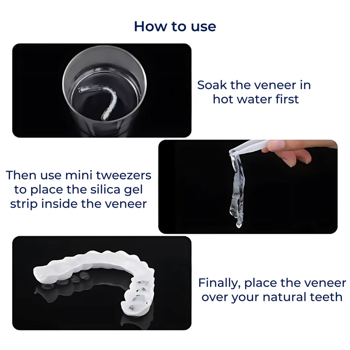 SmileEase | Clip-On Veneers – Instant Smile Enhancement – Ultra-Thin Design – Ideal for Adults Seeking Affordable Dental Solutions Bowlift