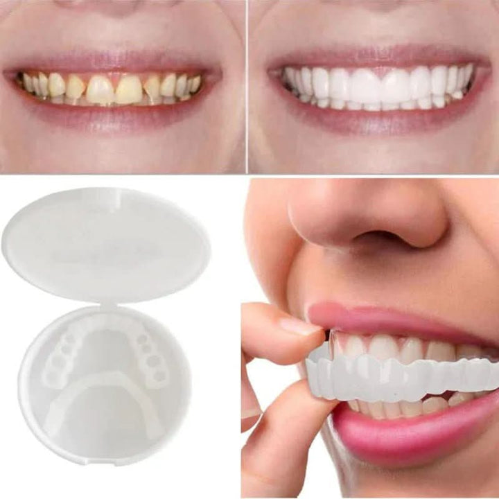 BowLift | Dental restoration for a bright white smile without a dentist