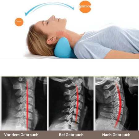 BowLift | Ergonomic Neck Massage Pillow for Relaxed Posture