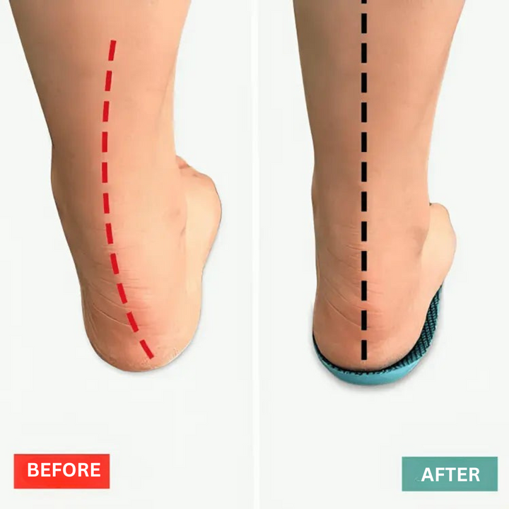 BowLift | Shoe Insoles with Gel Support for Comfort