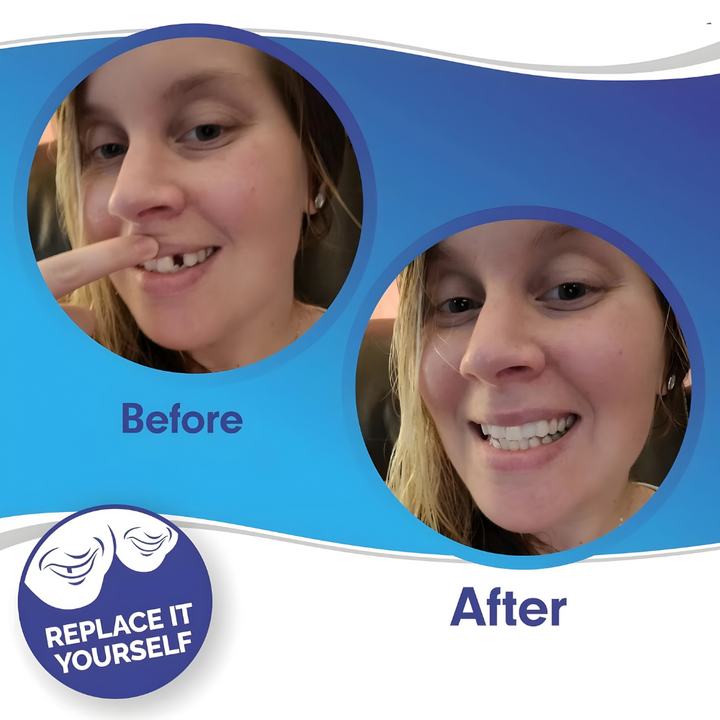 BowLift | Removable Veneers Teeth Cover