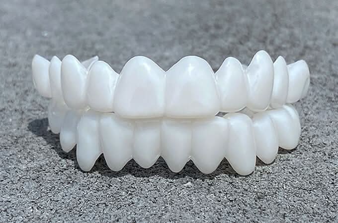 BowLift | SmileFlex Dental Prosthesis with White Veneers