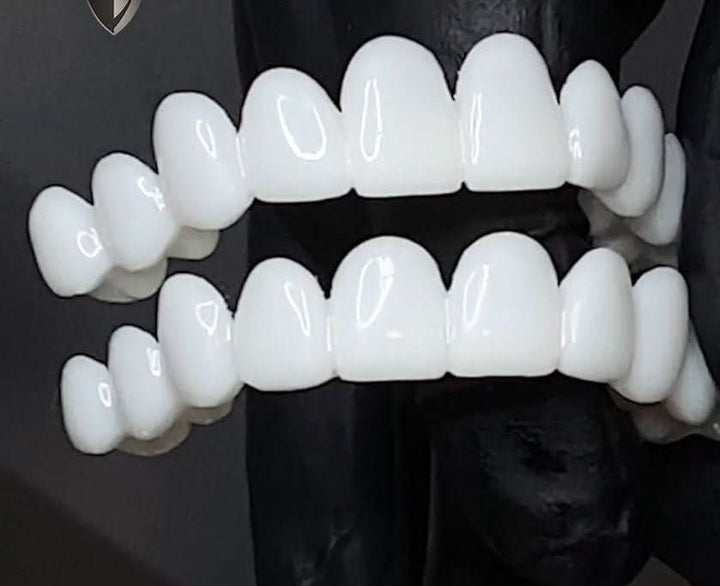BowLift | SmileFlex Dental Prosthesis with White Veneers