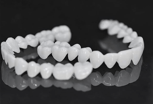 BowLift | SmileFlex Dental Prosthesis with White Veneers