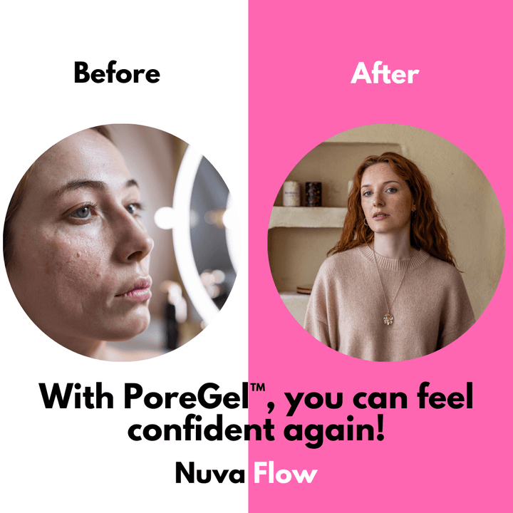 BowLift | SilkPores | Smooth and radiant skin
