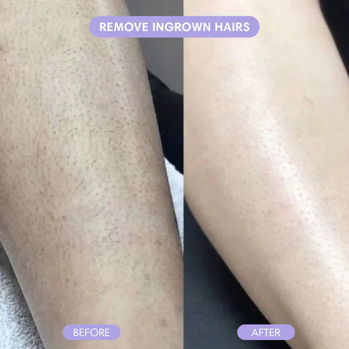 BowLift | DualTrim Precision Shave Comfort