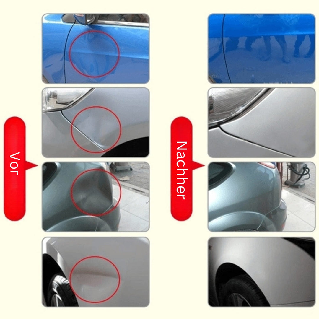DeukFix Repair Set – Car Dents Removal Without Paint Damage | Bowlift