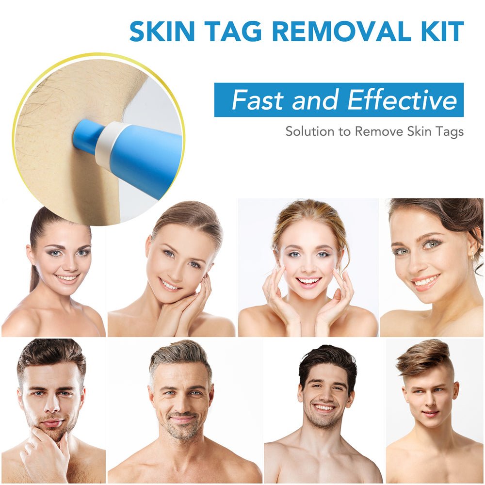 BowLift | EPICLEAR – At-Home Skin Tag & Wart Remover Kit