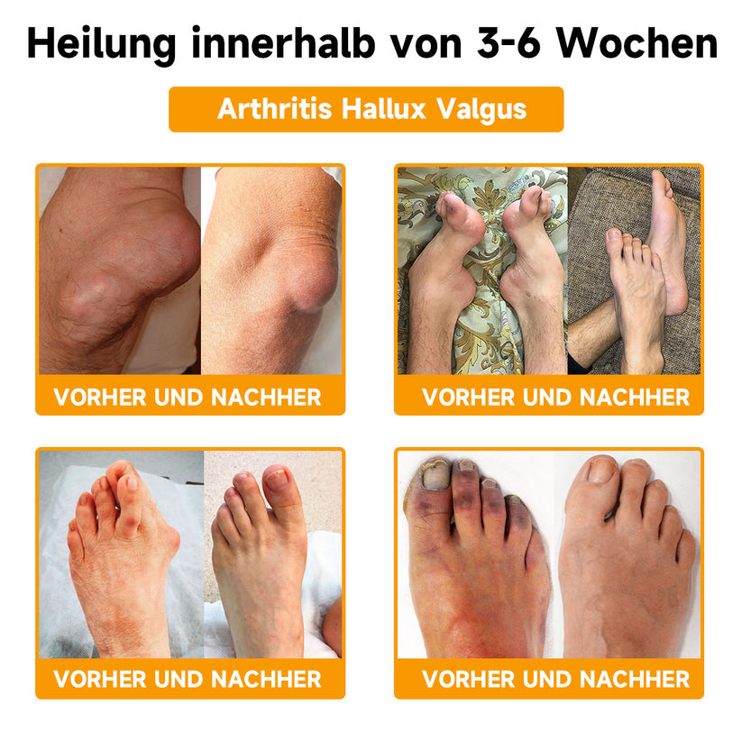 Bienen-Vital-Creme | Quick Pain Relief | Bowlift
