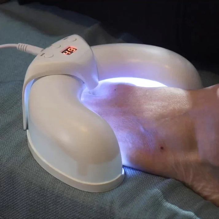 Nail therapy device | Home use, medication-free, nail fungus solution | Bowlift