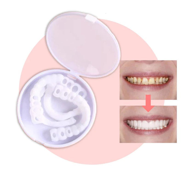 BowLift | Snap-on Teeth™ - With these veneers, always have the perfect smile