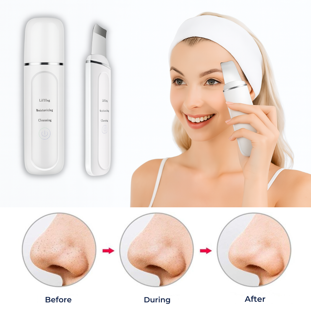 GlowSonic | Ultrasonic Facial Wand – Deep Cleansing – 33,000 Vibrations – At-Home Skincare Tool Bowlift