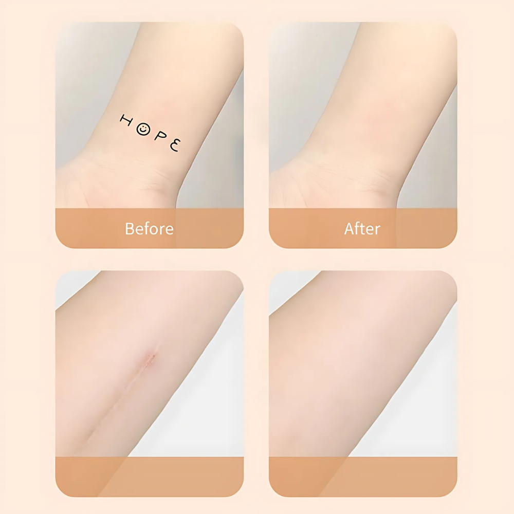 BowLift | Scar Concealer Patch Waterproof Skin Cover