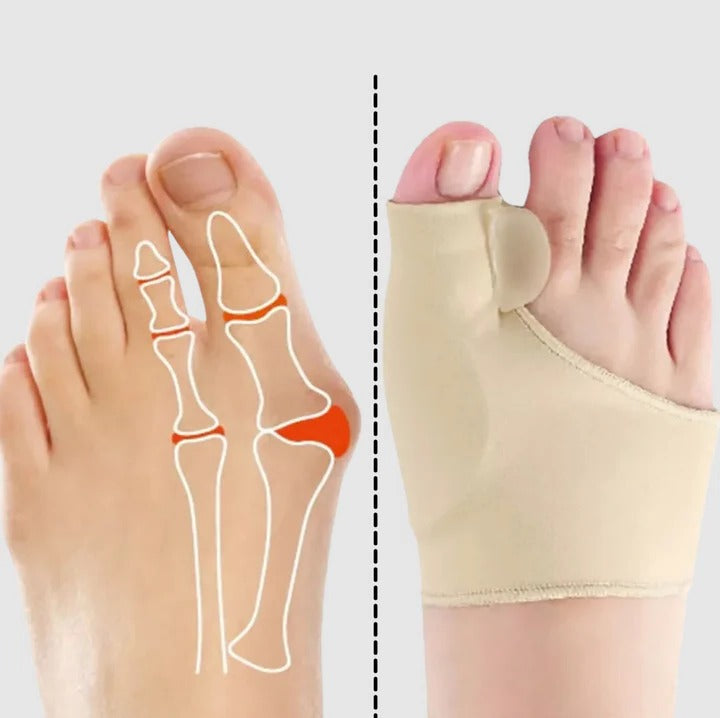 BowLift | Gel bunion corrector