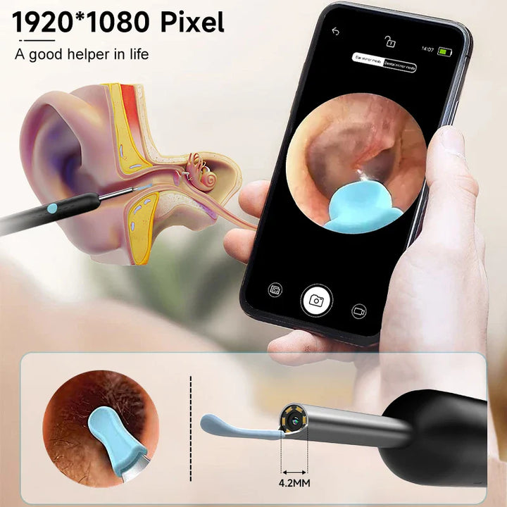 BowLift | Smart Ear Cleaner Camera