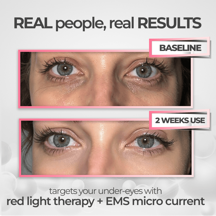 BowLift | EyeRevive | Radiance and freshness regained