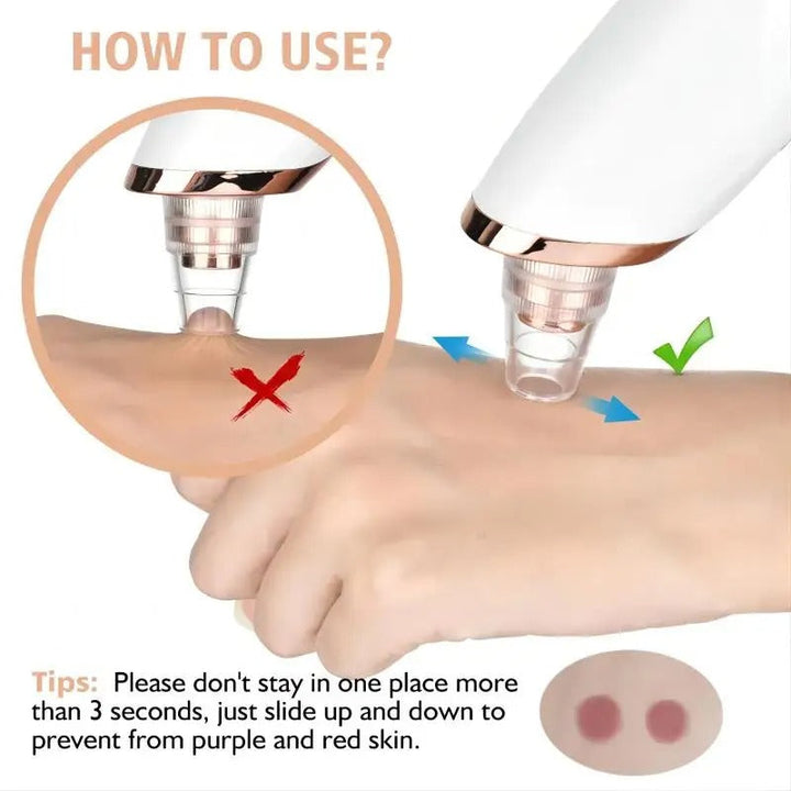 BowLift | Blackhead Remover Vacuum Pore Cleaner | Adjustable Suction, Multi-Functional Tool for Deep Cleansing & Acne Treatment at Home