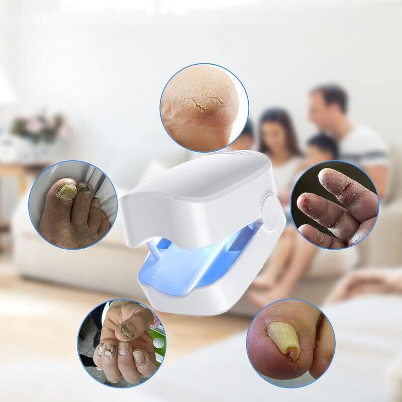 BowLift | Laser device for nail fungus cleaning – Revolutionary, highly efficient light therapy device from Expert for toe nail conditions