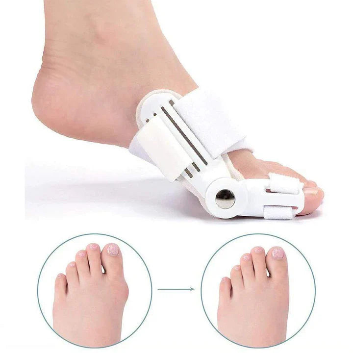 BowLift | Hallux Valgus correction splint (1 pair)