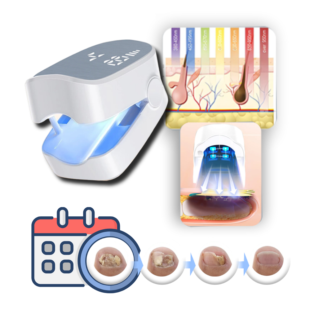 BowLift | Painless Nail Fungus Laser